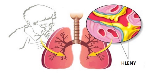 plíce a průdušky